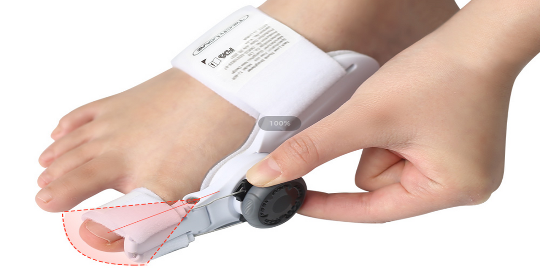 Do Bunion Correctors Actually Work to Treat Bunions and Relieve Pain?